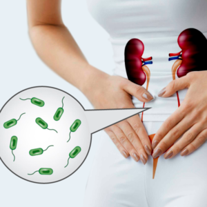 Infecção Urinária Infecção Urinária