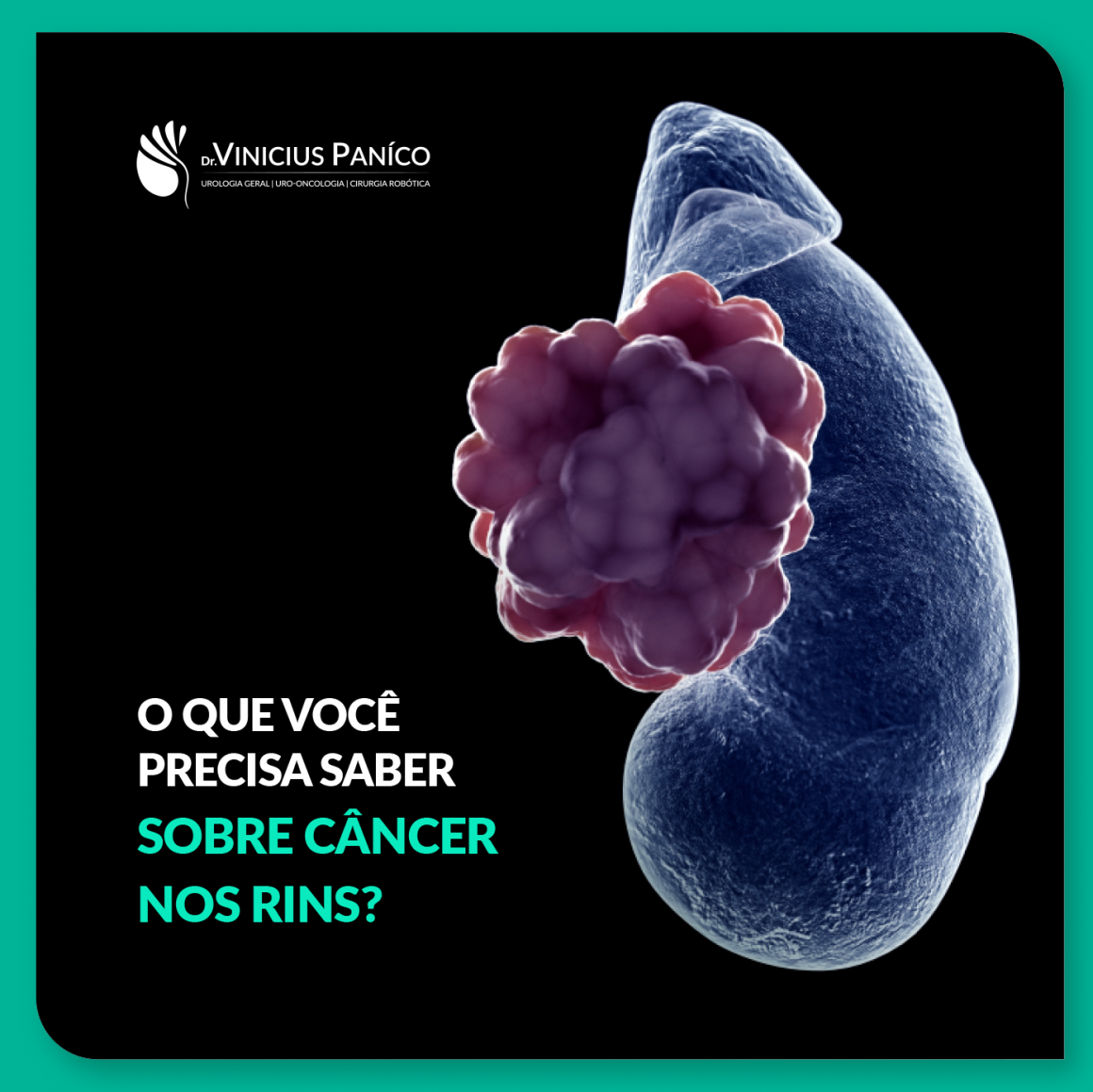 O que você precisa saber sobre câncer nos rins? O que você precisa saber sobre câncer nos rins?