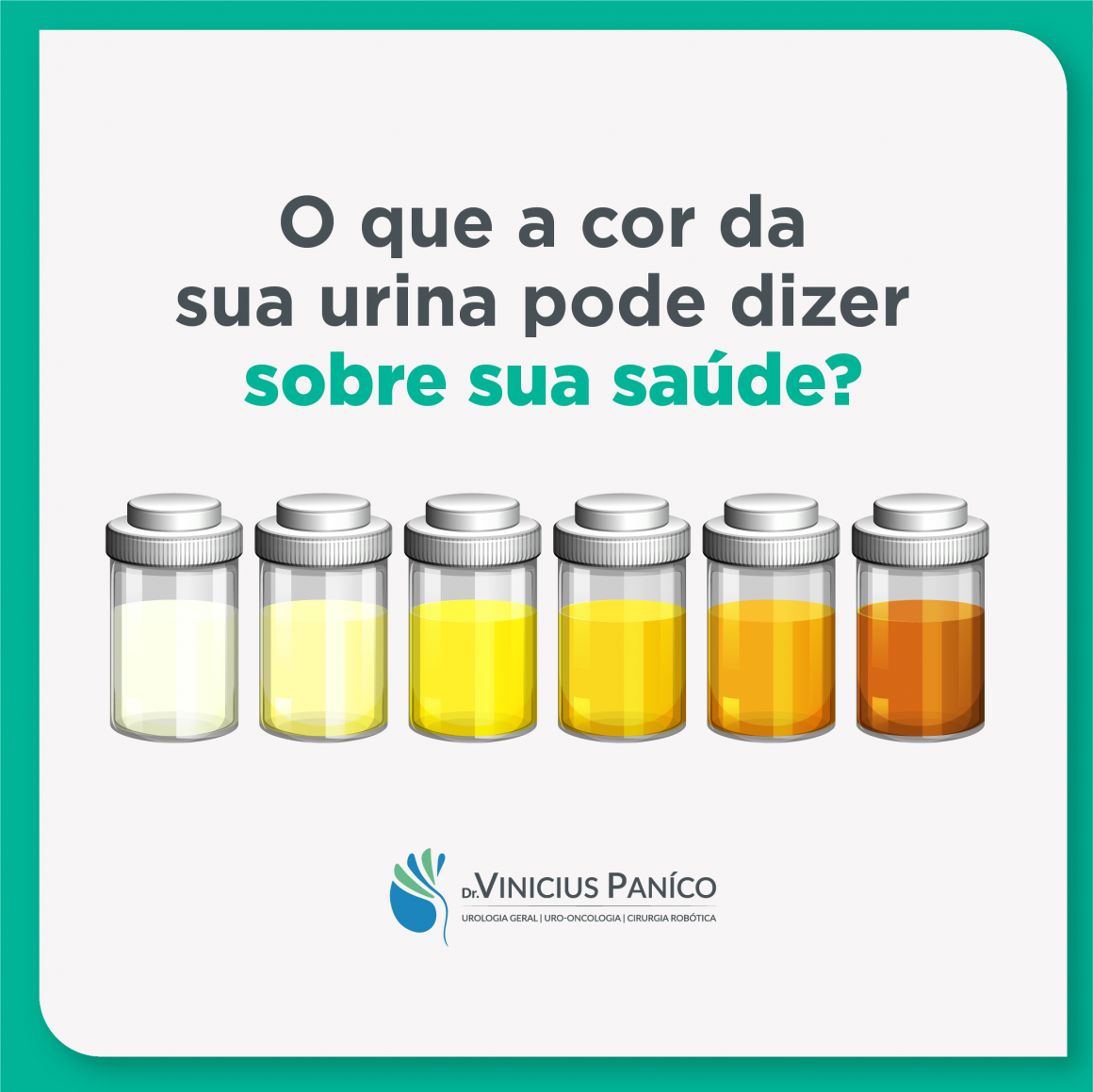 O que a cor da sua urina pode dizer sobre a sua saúde? O que a cor da sua urina pode dizer sobre a sua saúde?