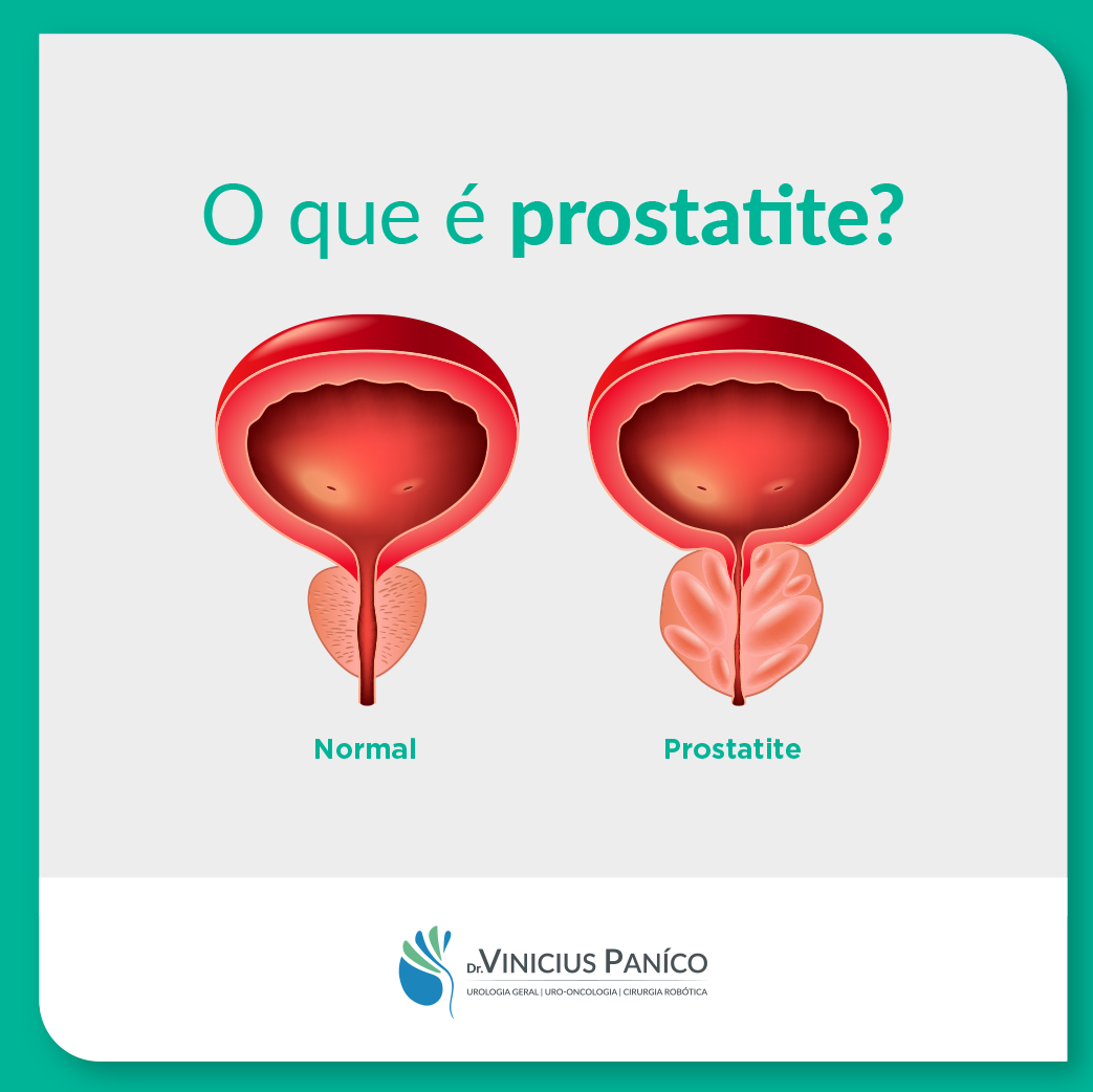 O que é prostatite?